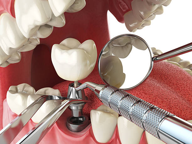 Best Cracked Tooth Emergency Dentist  in Somerville, TN